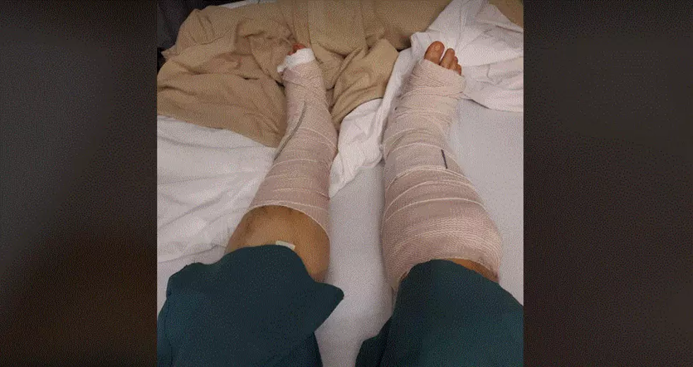 West Richland Hit and Run Victim Needs Your Help!